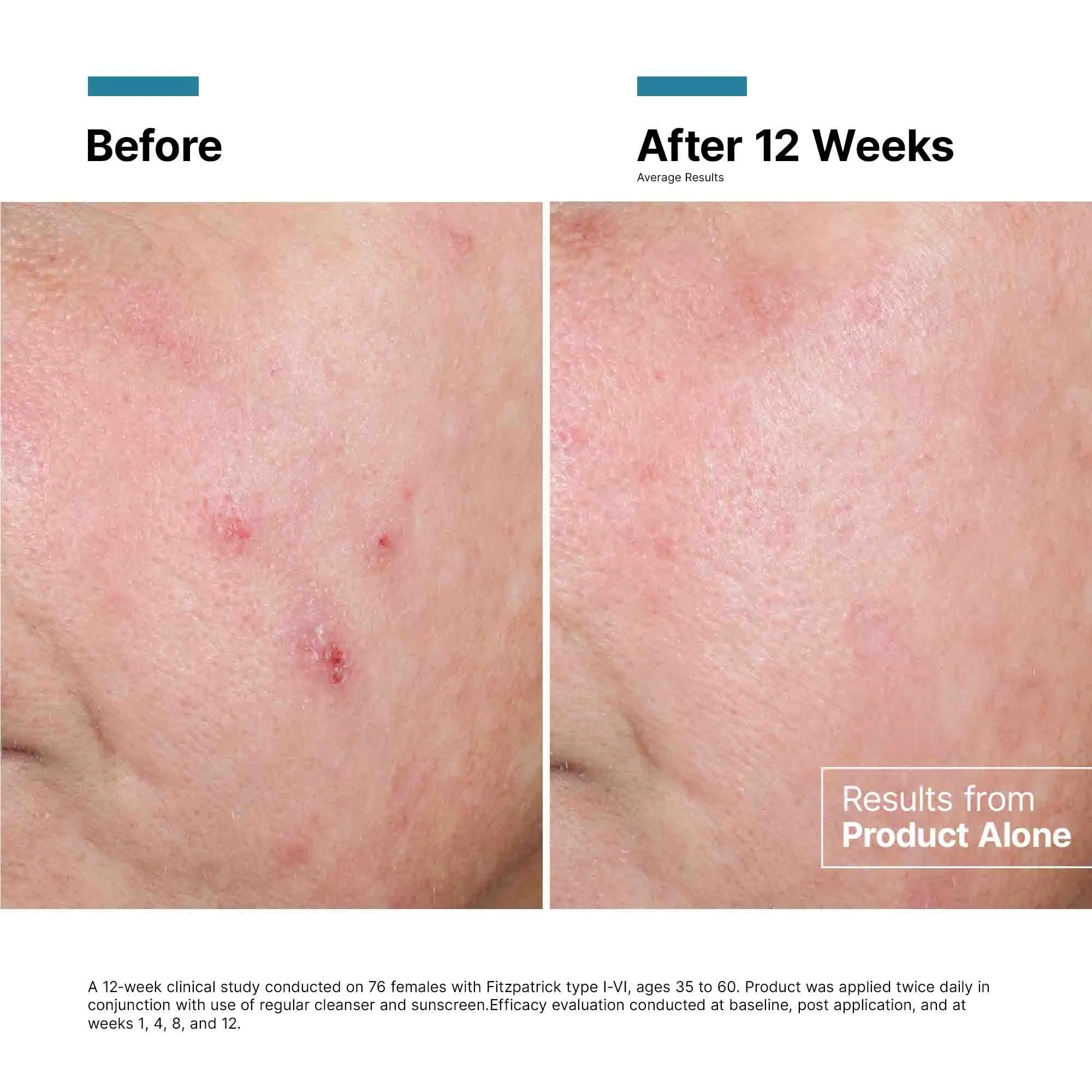 Advanced RGN-6 Regenerative Cream