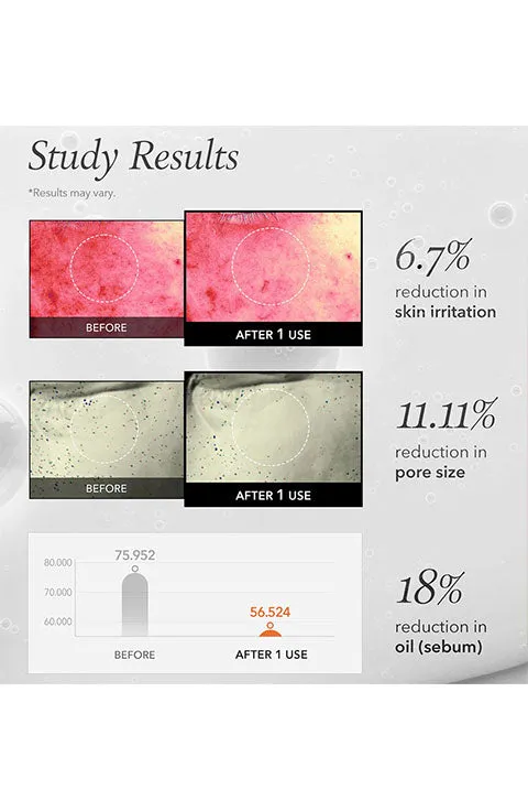 [APRIL SKIN] Carrotene IPMP Instant Calming Serum Pads(80Pads)