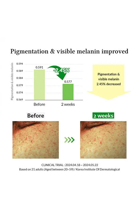 [Dr.Althea] Gentle Vitamin C Serum (30mL/1.01fl.oz)